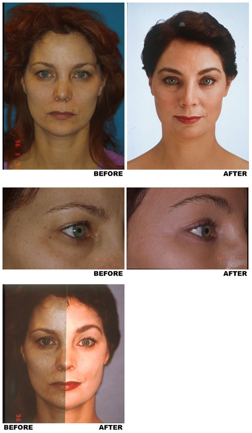 eyebrows-1