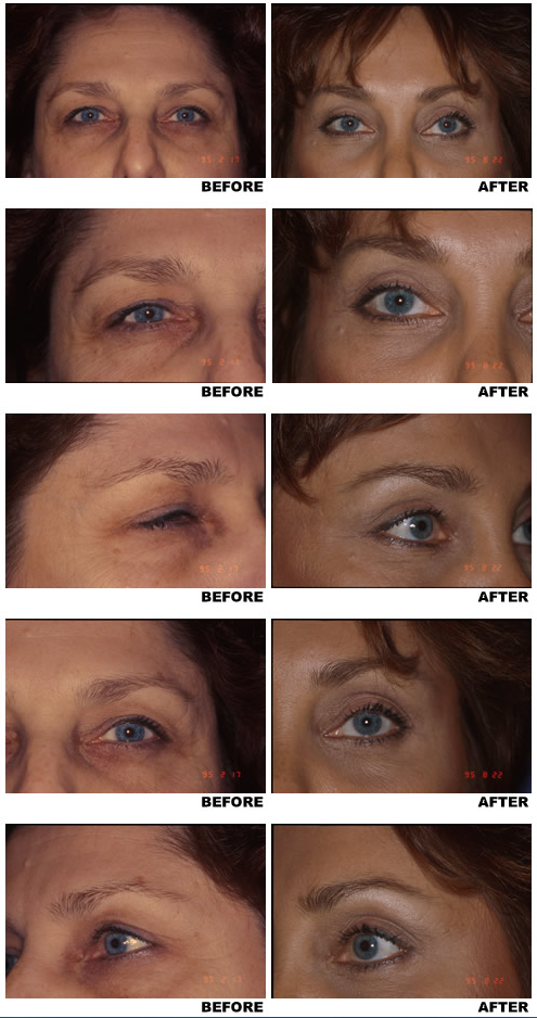 eyebrows-2