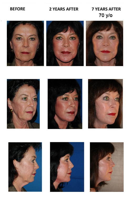 face-8